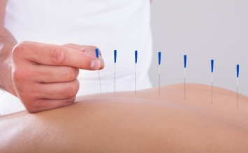 Châm cứu có phải là trị liệu hiệu quả?